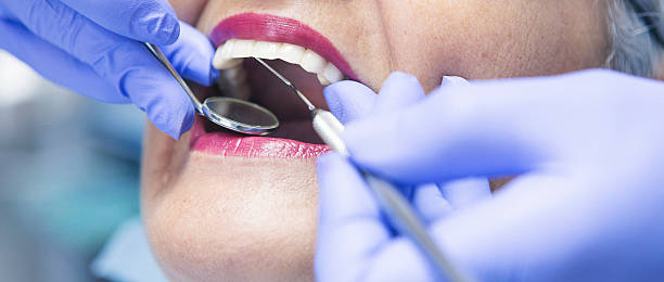 Best Emergency Dentist for Knocked-Out Tooth in Del Mar, CA
